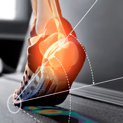 Se vería una imagen sobre el estudio de la pisada